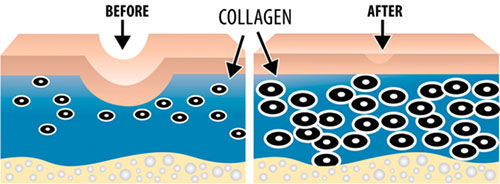Chống lão hóa tái tạo Collagen
