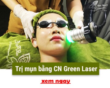 Điều trị mụn bằng công nghệ Green Laser - Cam kết hiệu quả