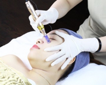Phi kim vi điểm - Công nghệ trị sẹo rỗ da mặt với tế bào gốc